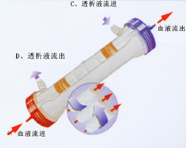 血液透析原理--中新华美改性塑料